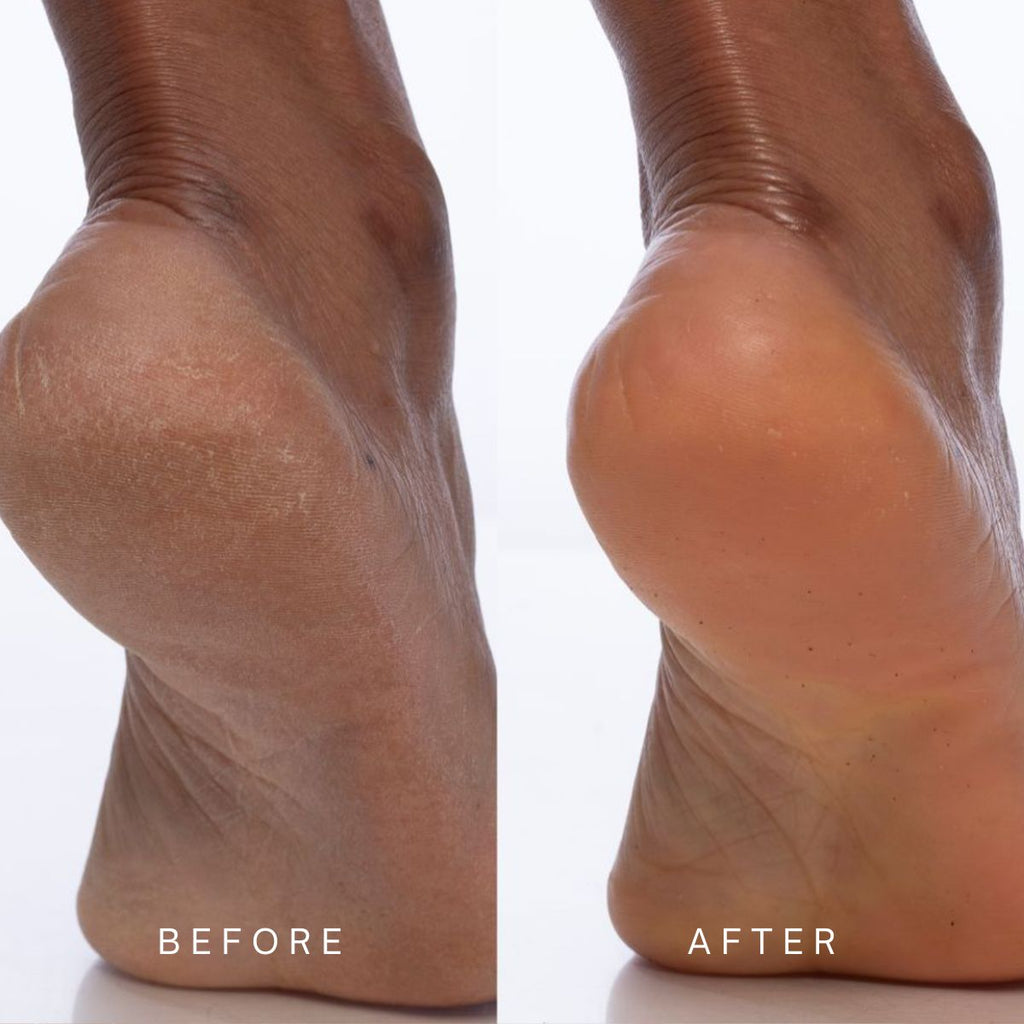 Tiare Jasmine Body Creme before and after - Awear