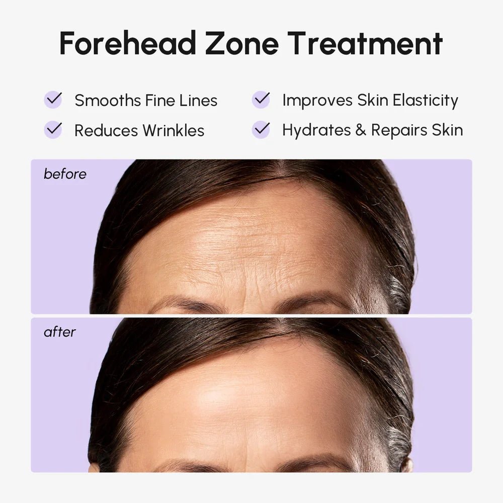Anti-Wrinkle Forehead Patches - Awear